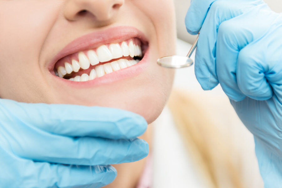 Closeup of a woman smiling at the dentist during her routine cleaning as blue gloved hands hold a special dental mirror