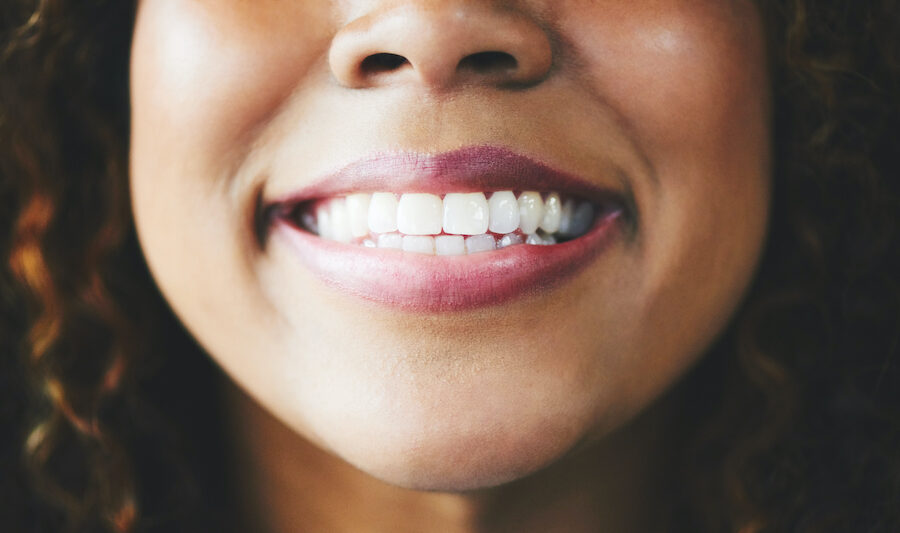 Closeup of a Black woman smiling after improving her smile at Alma Dental Care in Petaluma, CA
