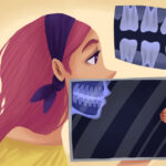 Side profile illustration of a woman getting a dental X-ray image
