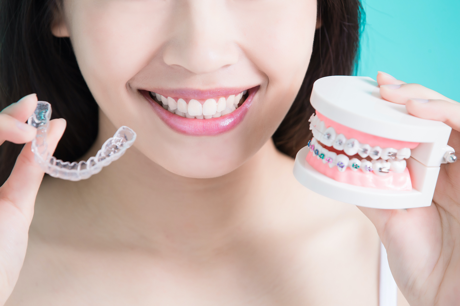 A young woman holds up clear aligners next to a teeth model wearing traditional braces