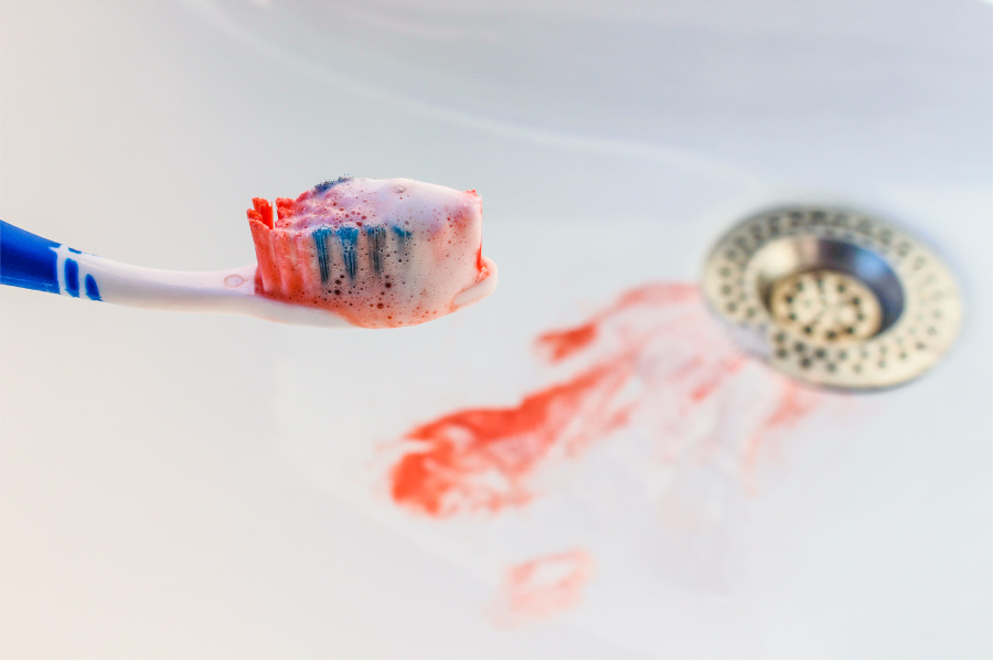 Closeup of a toothbrush with blood on its bristles over a sink with foamy blood near the drain from bleeding gums