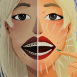Graphic illustration of a woman comparing traditional braces to clear aligner therapy to achieve a straight smile.