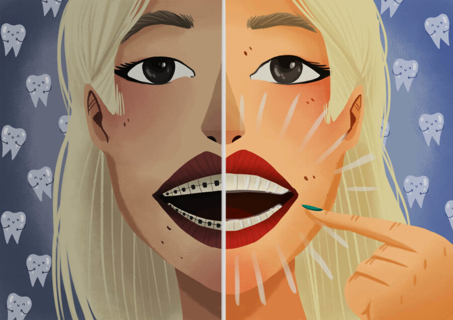 Graphic illustration of a woman comparing traditional braces to clear aligner therapy to achieve a straight smile.