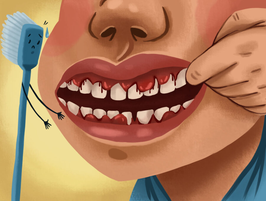 Graphic illustration of person with bleeding gums.