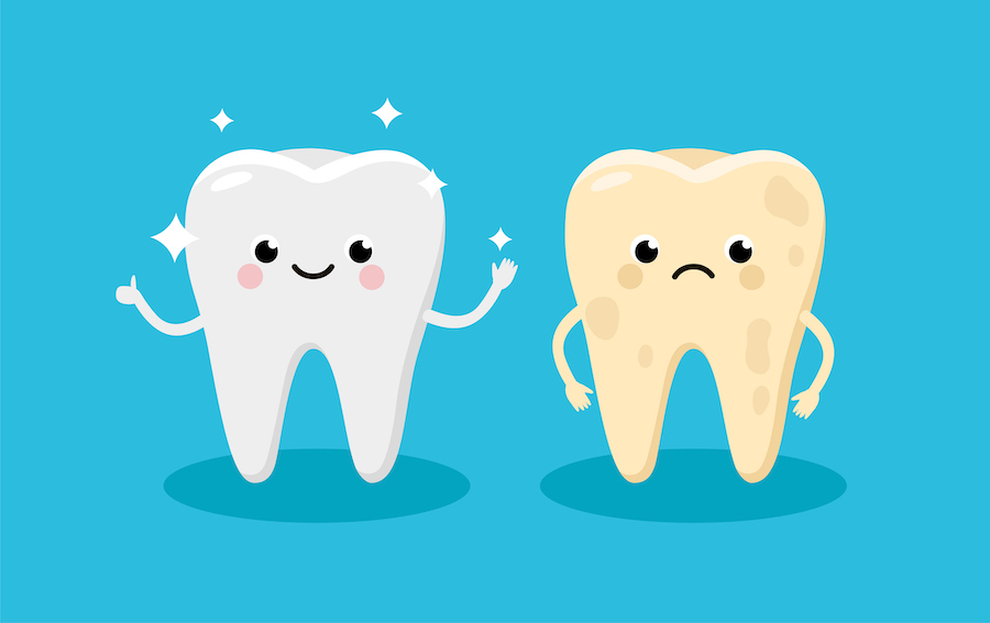 Vector illustration of two teeth, one yellow tooth before teeth whitening and one smiling white tooth after teeth whitening.