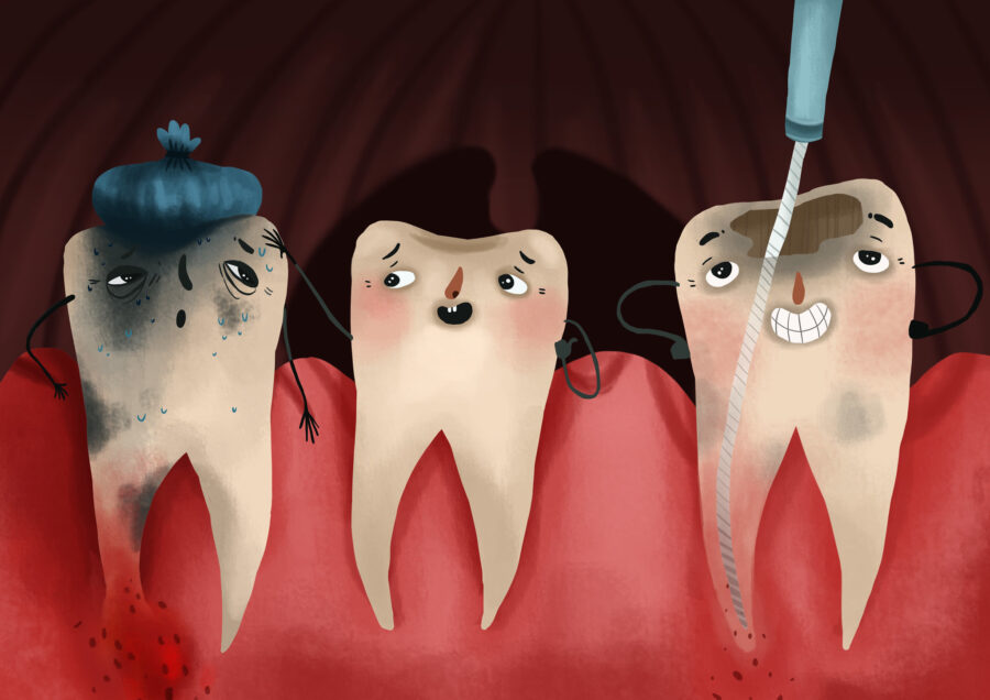 emergency root canal, toothache, root canal, emergency dentist