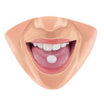 sedation dentistry, dental anxiety, Alma Dental Care, Petaluma, dental care, nitrous oxide, oral sedation, IV sedation