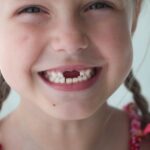 when your child's tooth falls out, child tooth loss, dental care for kids, baby teeth, oral hygiene for children, Petaluma dentist, pediatric dental care