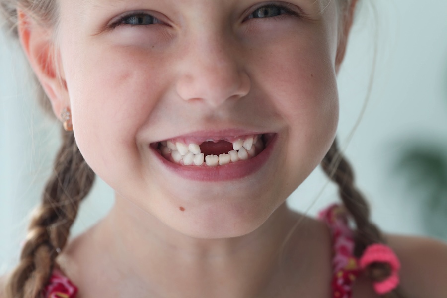 when your child's tooth falls out, child tooth loss, dental care for kids, baby teeth, oral hygiene for children, Petaluma dentist, pediatric dental care