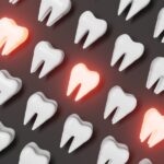 dental emergency, knocked-out tooth, severe toothache, broken tooth, cracked tooth, bleeding gums, Alma Dental Care, Petaluma