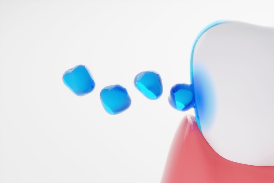 fluoride and cavities fluoride treatment can help with cavities