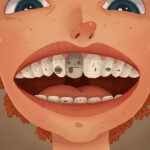 man with grey tooth from trauma