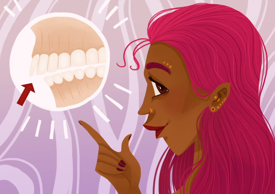 woman with overbite considering clear aligner therapy