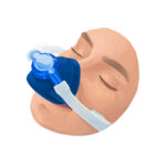 woman getting nitrous oxide and type of dental sedation
