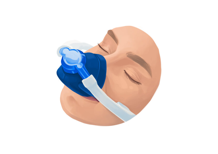 woman getting nitrous oxide and type of dental sedation