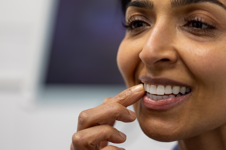 woman with sensitivity after dental veneers sensitive veneers
