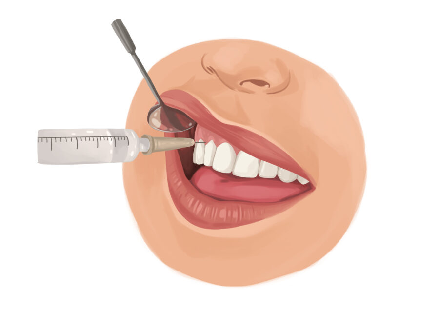 woman receiving local anesthesia for dental extraction at a dentist office